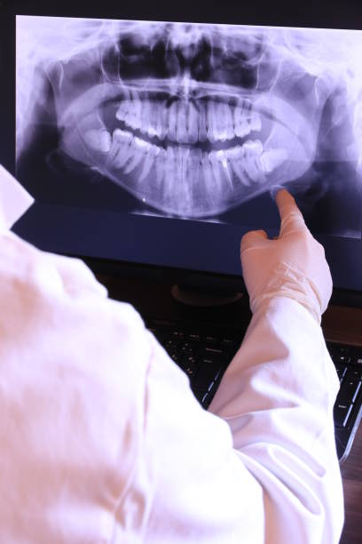Best Emergency Wisdom Teeth Removal in Desert View Highlands, CA