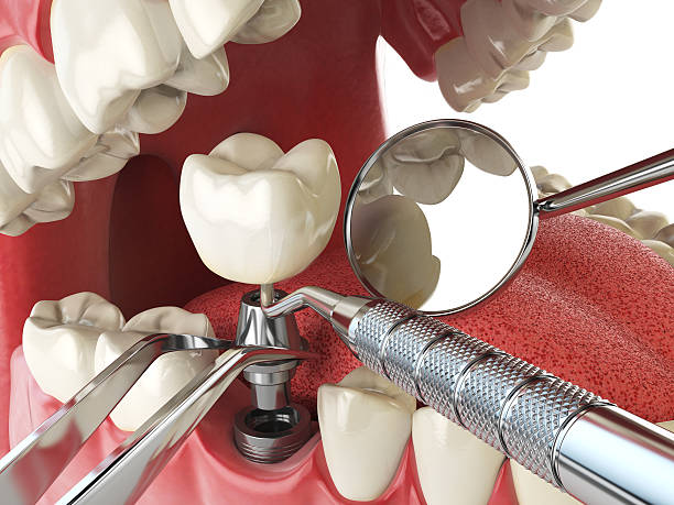 Best Emergency Dental Care for Broken or Chipped Teeth in Desert View Highlands, CA